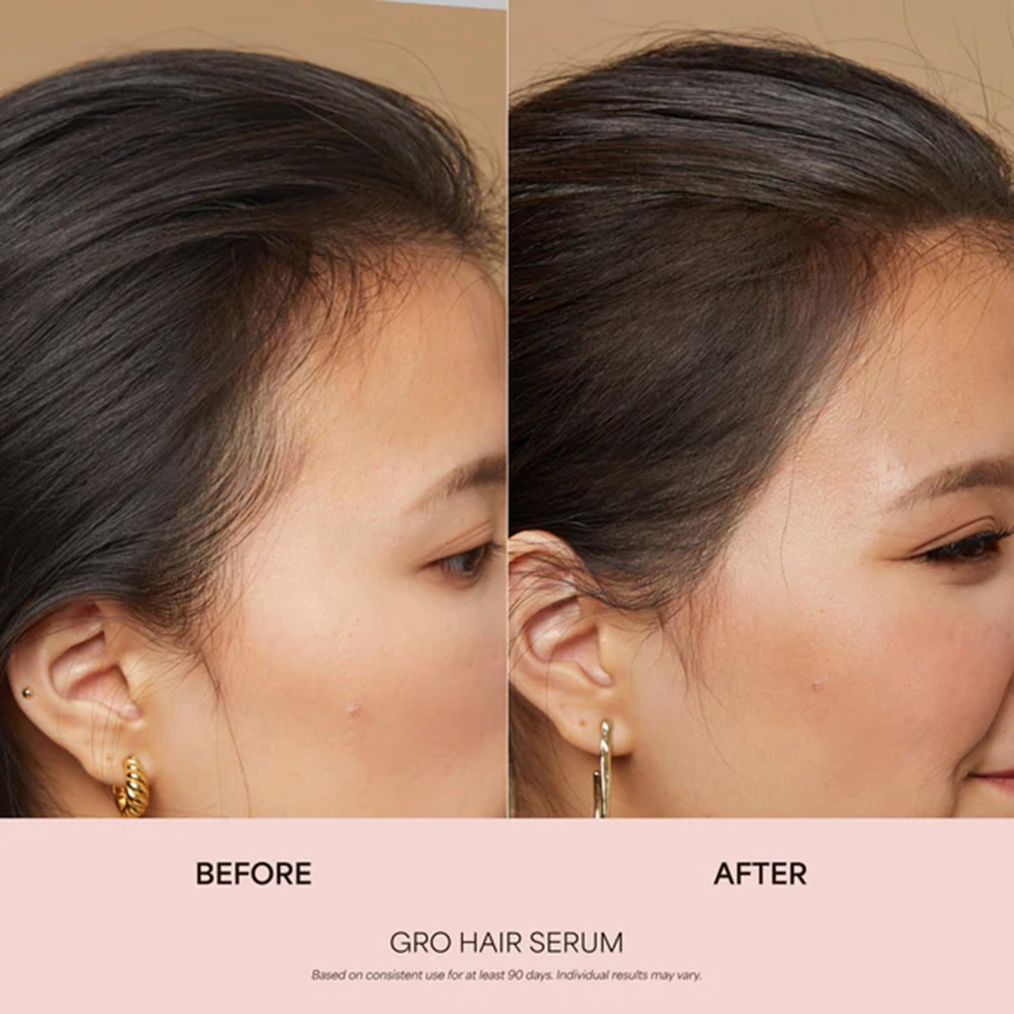 VEGAMOUR GRO Hair Serum for Hair Thinning & Shedding, Thicker Fuller Looking Hair In As Soon As 90 Days, Non Oily, Bergamot Scent, Vegan & Cruelty Free