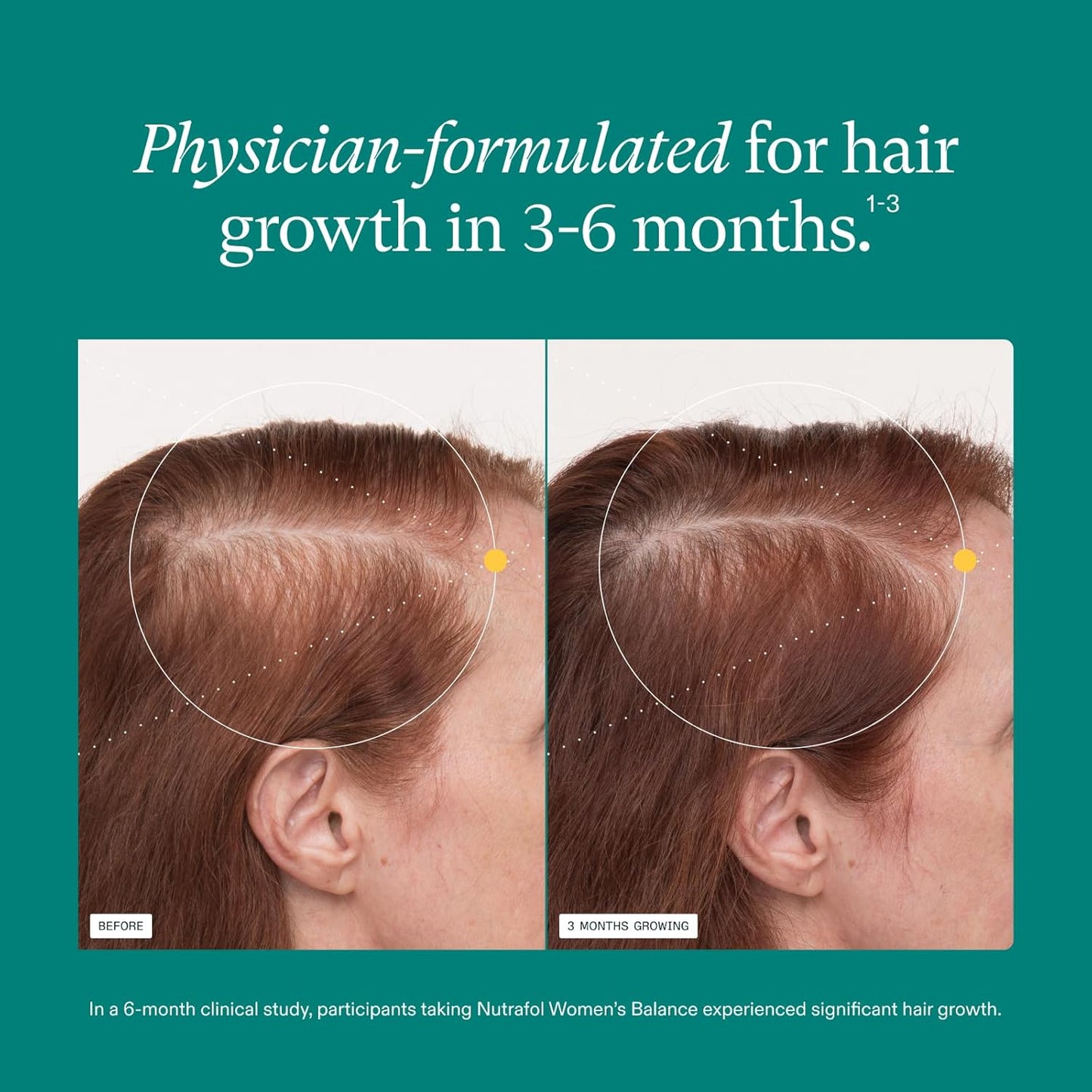 Nutrafol Women's Balance Hair Growth Supplements, Ages 45 and Up, Clinically Tested for Visibly Thicker Hair and Scalp Coverage, Dermatologist Recommended - 1 Month Supply