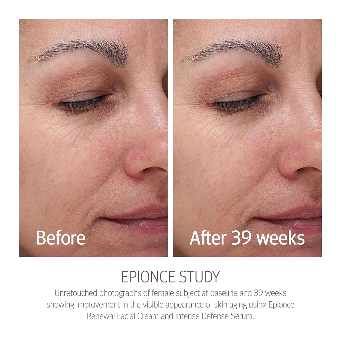 Epionce Renewal Facial Cream – Hydrating Anti-Aging Moisturizer | For Dry, Sensitive to Normal Skin | Fine Lines & Wrinkles | Dermatologist Skincare