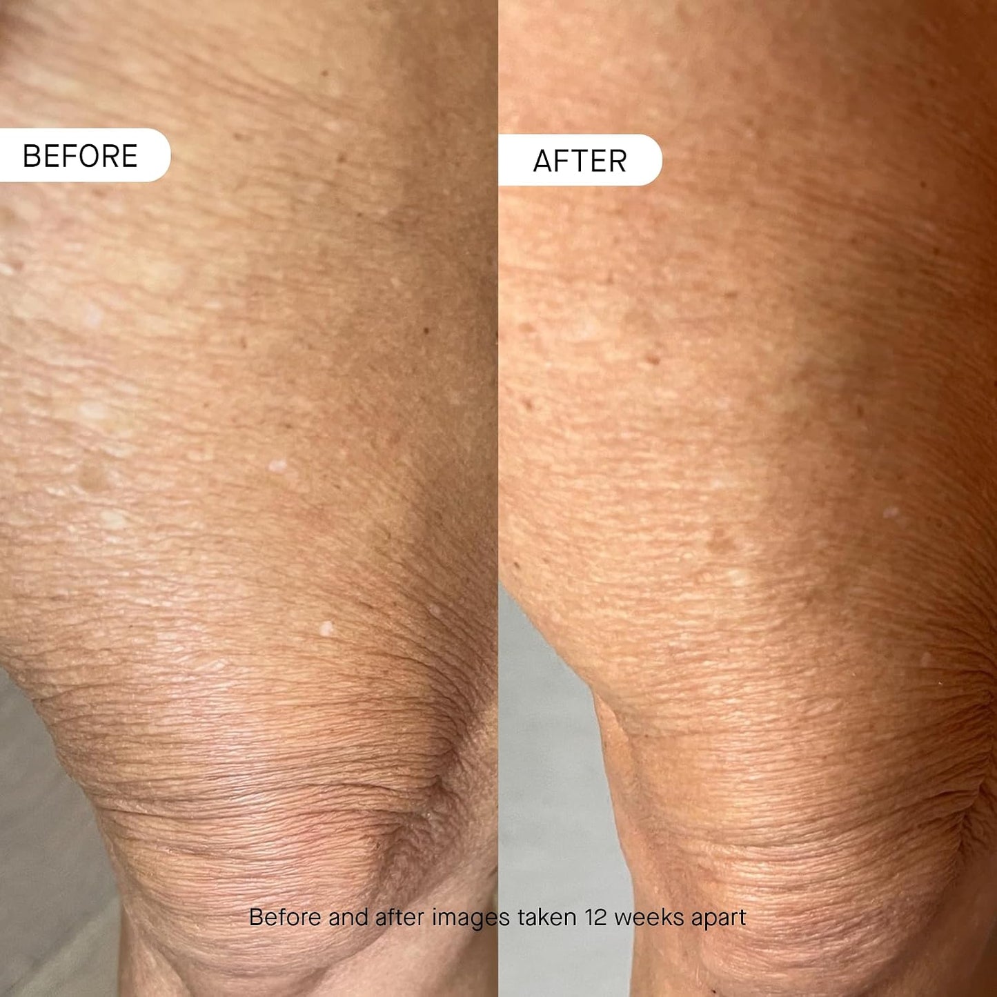 OneSkin BODY OS-01 Peptide Topical Supplement & Skin Longevity Age Reversal Moisturizer | Safe for Sensitive Skin, Fragrance-Free, 250 mL / 8.45 oz